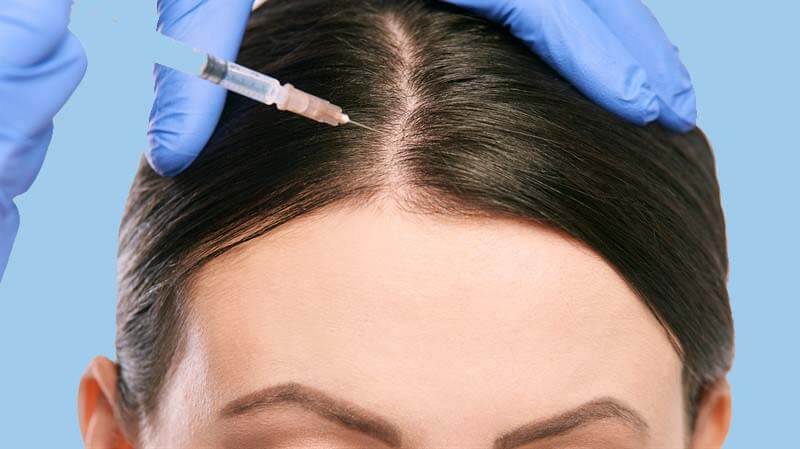 Hair mesotherapy