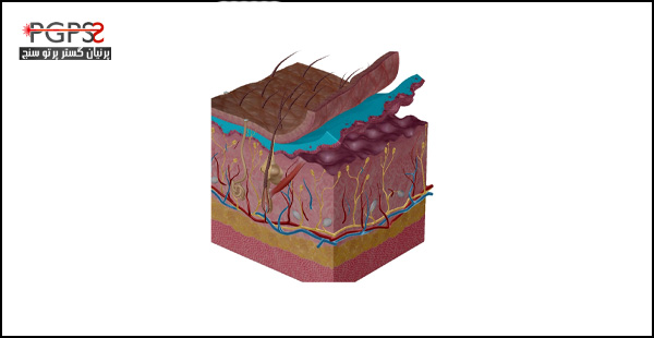 عکس لایه های پوست