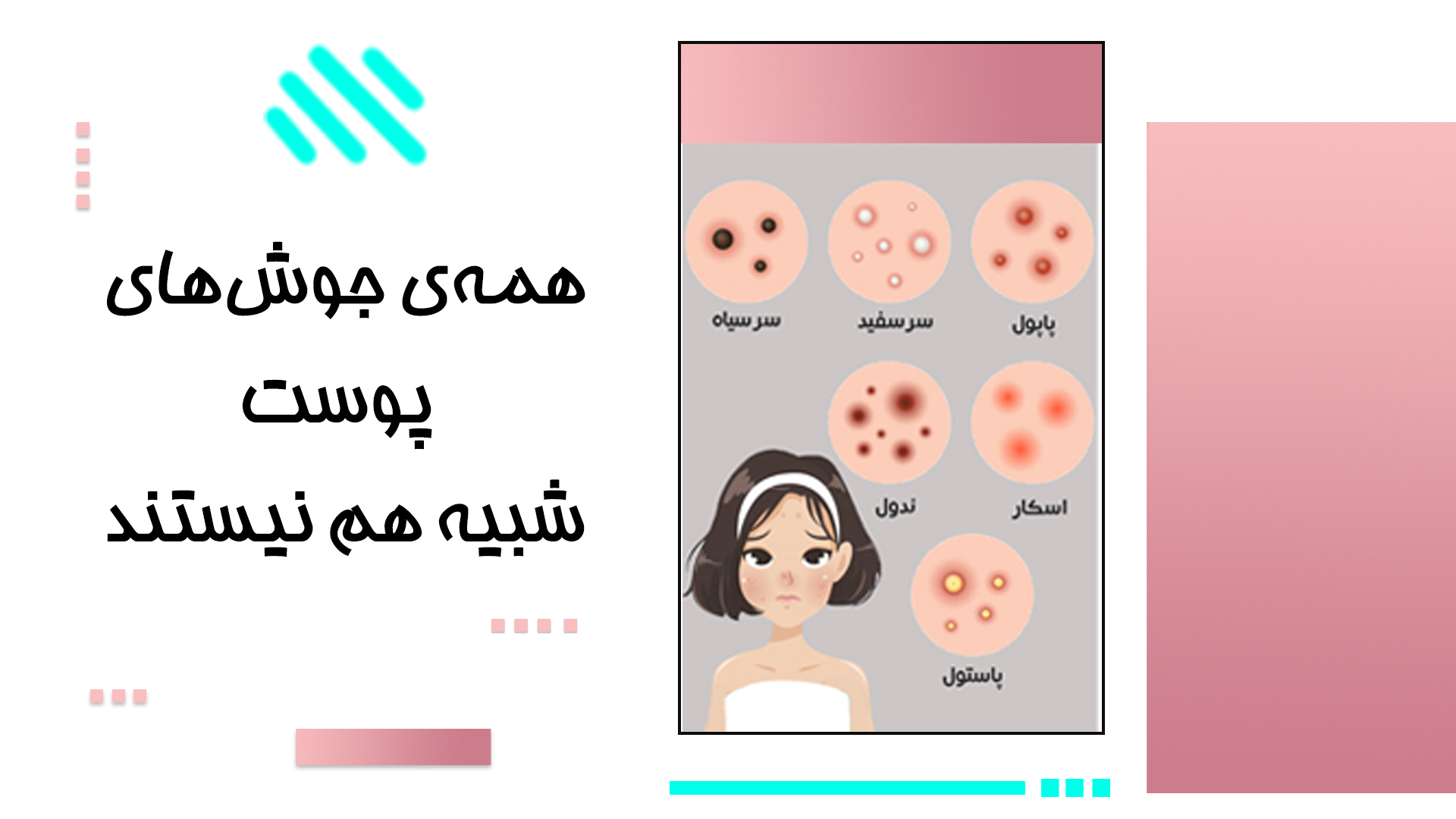 آشنایی با انواع جوش های پوستی