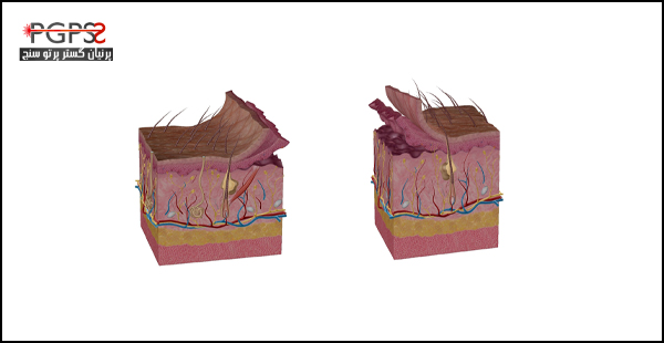 عکس لایه های پوست