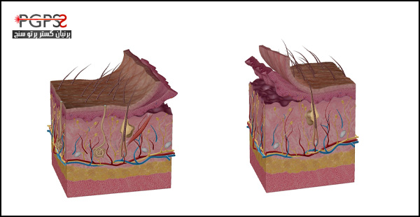 عکس لایه های پوست