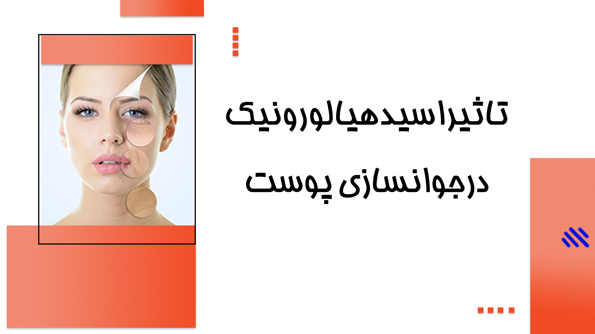 تاثیر اسید هیالورونیک در جوانسازی پوست